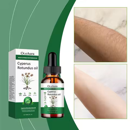 Cyperus hair removal serum